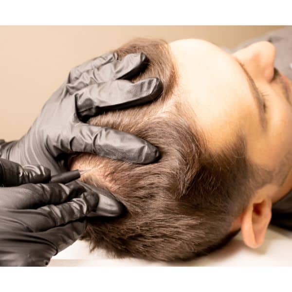 Hair-Restoration | ReVi Aesthetics + Wellness | Miramar Beach, Florida