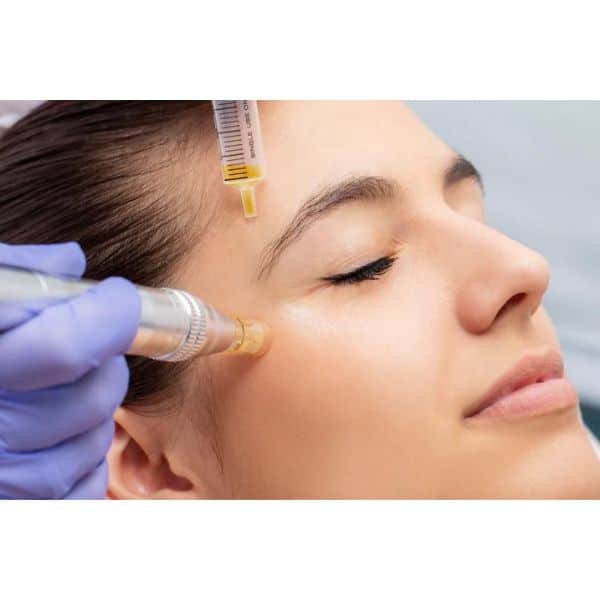 Microneedling | ReVi Aesthetics + Wellness | Miramar Beach, Florida