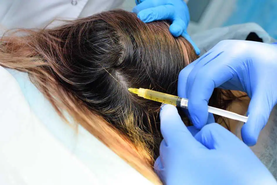 PRP Therapy for Hair Restoration in Miramar Beach, FL by Re’vi Aesthetics + Wellness