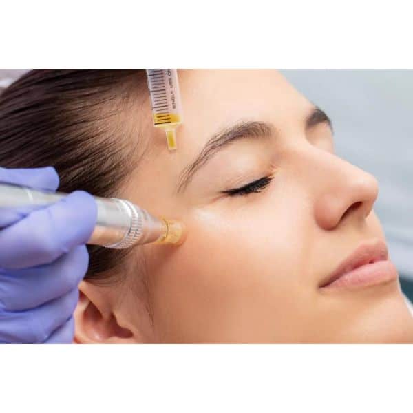 Collagen Induction Therapy | ReVi Aesthetics + Wellness | Miramar Beach, Florida