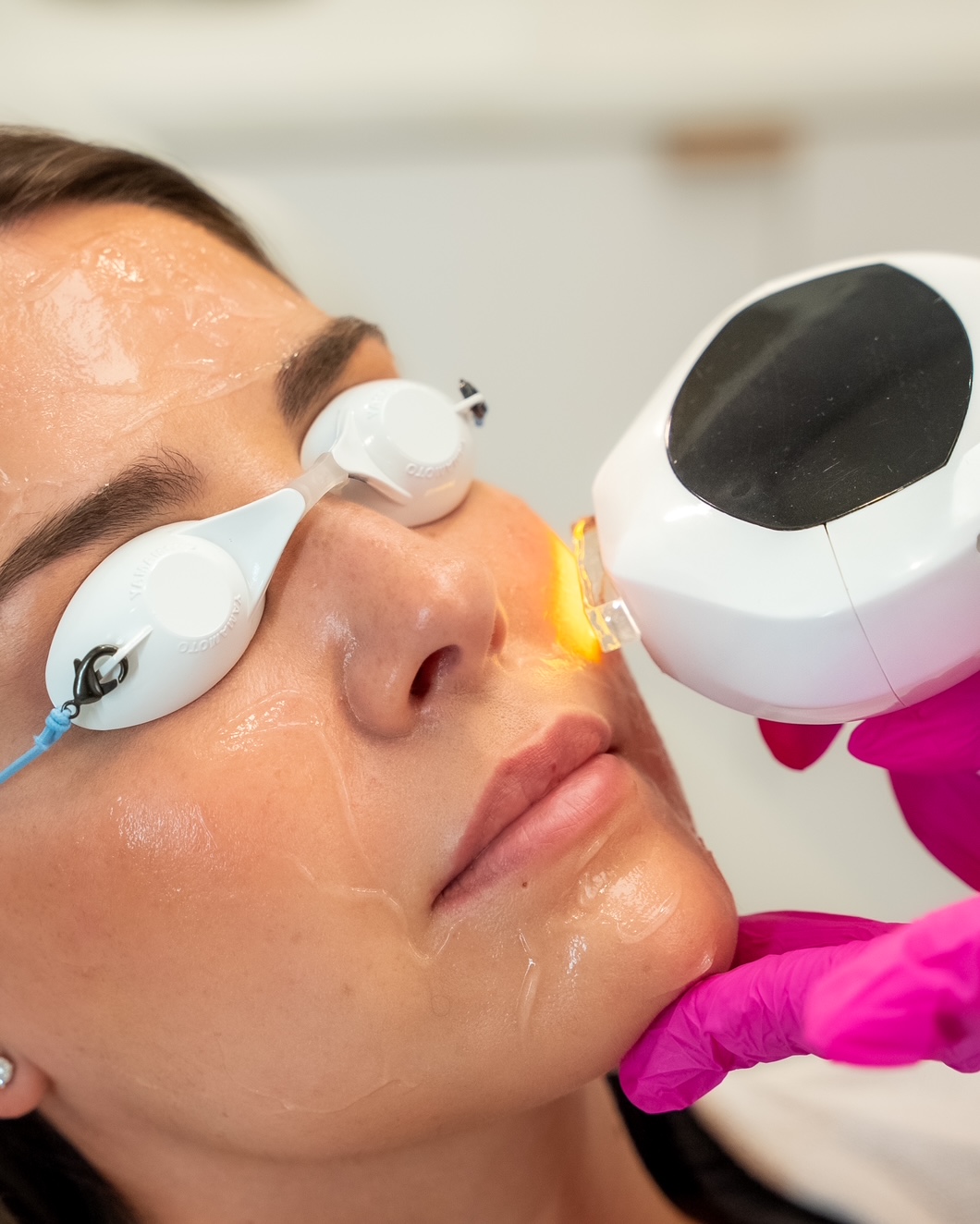 IPL Photofacial Med Spa Miramar Beach FL