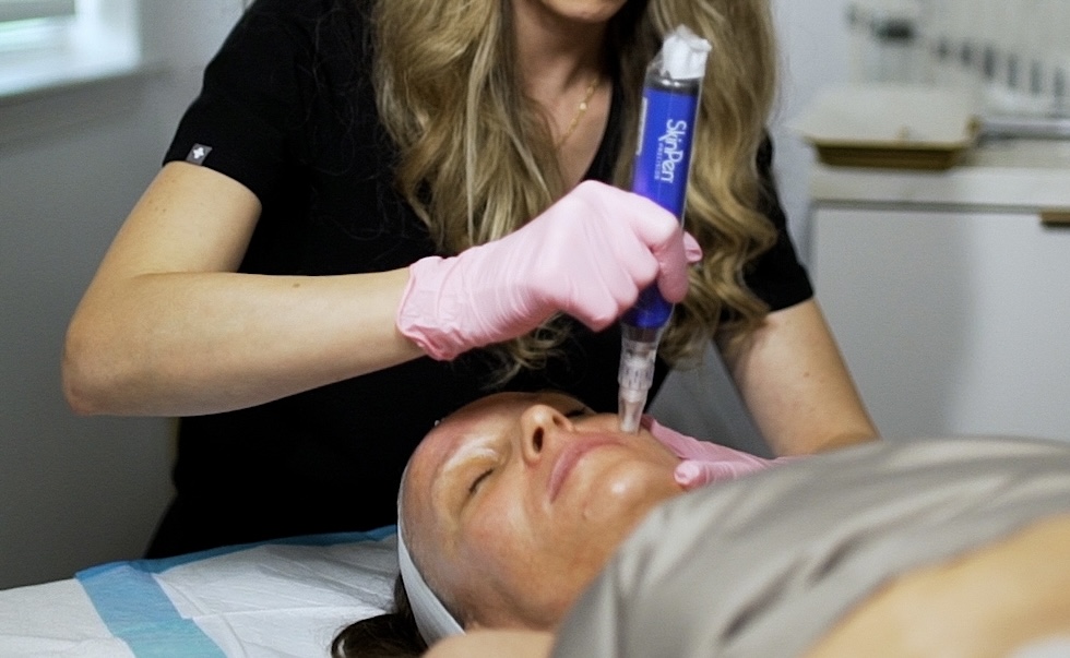 Microneedling Med Spa Miramar Beach FL