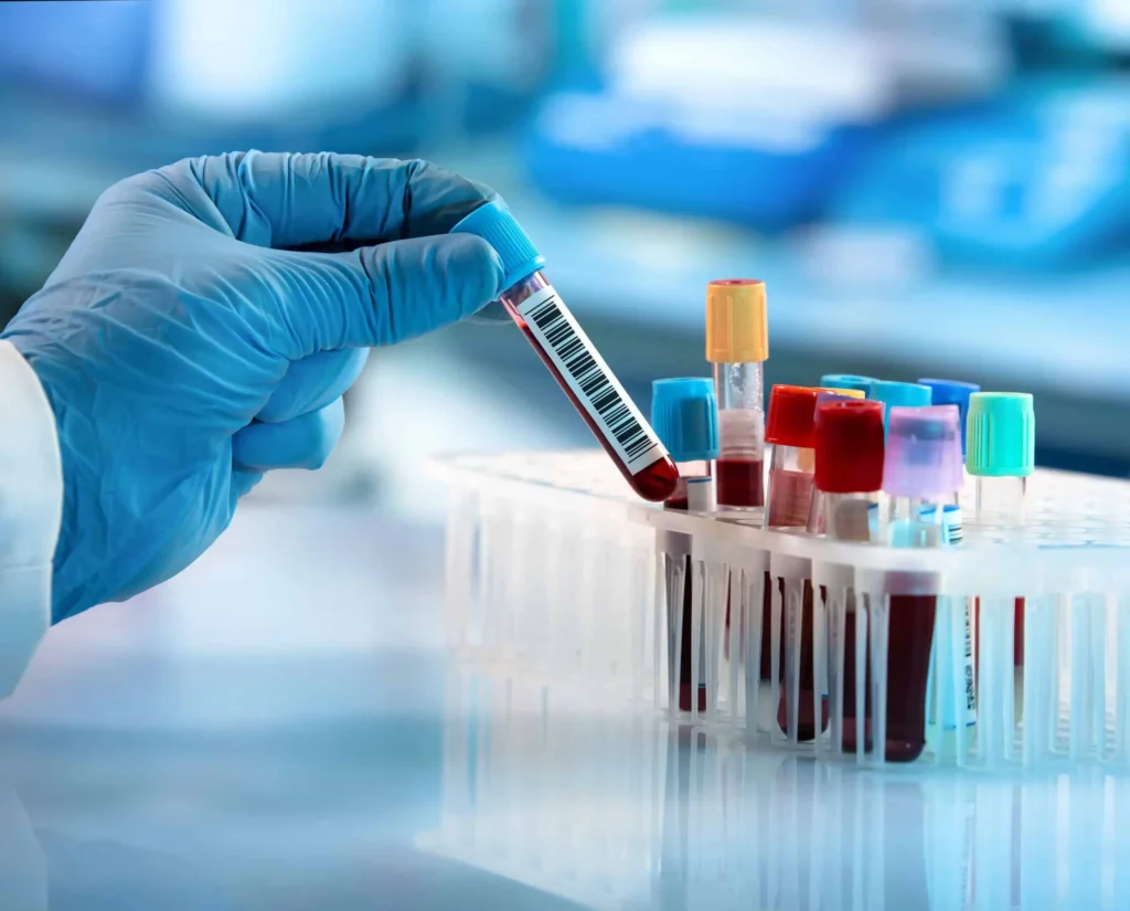 A patient receiving a comprehensive blood work analysis at ReviMedical in Miramar Beach, FL