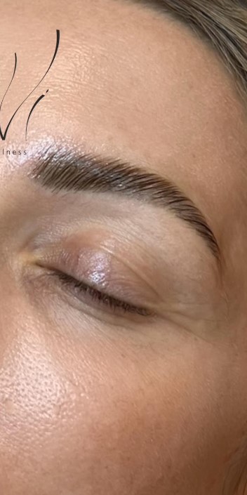 After Brow Lumination